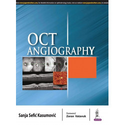 OCT ANGIOGRAPHY book by Sanja Sefic Kasumovic