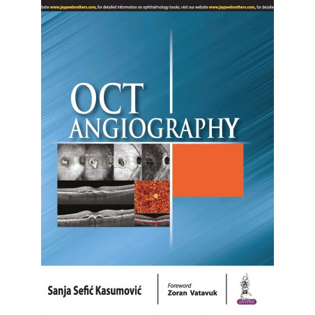 OCT ANGIOGRAPHY book by Sanja Sefic Kasumovic
