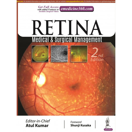 RETINA: MEDICAL & SURGICAL MANAGEMENT book by Atul Kumar