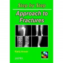 Step by Step Approach to Fractures with Photo CD-ROM book by Anwar