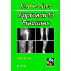 Step by Step Approach to Fractures with Photo CD-ROM book by Anwar