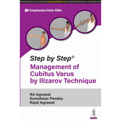 STEP BY STEP MANAGEMENT OF CUBITUS VARUS BY ILIZAROVE TECHNIQUE book by RA Agrawal, Sureshwar Pandey