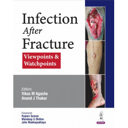 Infection After Fracture: Viewpoints & Watchpoints for Orthopedic Surgeons, Trauma Surgeons & PG Trainees | PICASSO Protocol…