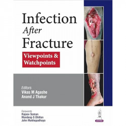 Infection After Fracture: Viewpoints & Watchpoints for Orthopedic Surgeons, Trauma Surgeons & PG Trainees | PICASSO Protocol… -