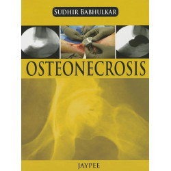 OSTEONECROSIS book by Babhulkar Sudhir