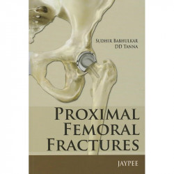 Proximal Femoral Fractures book by Babhulkar Sudhir