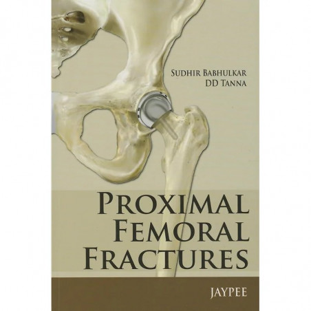 Proximal Femoral Fractures book by Babhulkar Sudhir