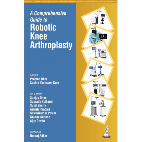 A Comprehensive Guide to Robotic Knee Arthroplasty: A One-Stop Reference for Orthopedic Surgeons on All 6 Robotic TKA Platfo…