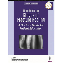 HANDBOOK ON STAGES OF FRACTURE HEALING A DOCTOR'S GUIDE FOR PATIENT EDUCATION book by Rajendra M Chandak
