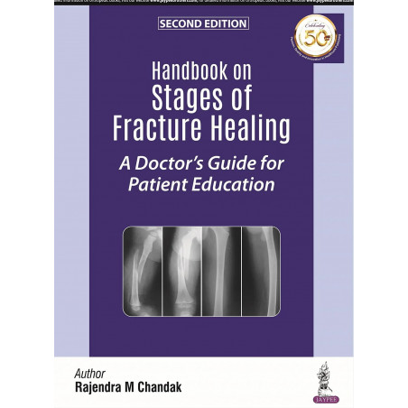 HANDBOOK ON STAGES OF FRACTURE HEALING A DOCTOR'S GUIDE FOR PATIENT EDUCATION book by Rajendra M Chandak