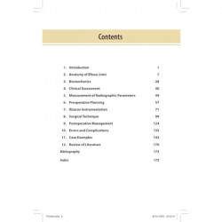STEP BY STEP MANAGEMENT OF CUBITUS VARUS BY ILIZAROVE TECHNIQUE book by RA Agrawal, Sureshwar Pandey - Additional Image 6
