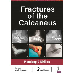 Fractures of the Calcaneus book by Mandeep S Dhillon