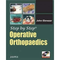 STEP BY STEP OPERATIVE ORTHOPAEDICS WITH PHOTO CD-ROM book by Ebnezar