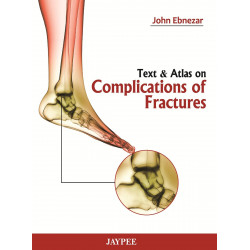 TEXT & ATLAS ON COMPLICATIONS OF FRACTURES book by John Ebnezar