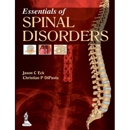 ESSENTIALS OF SPINAL DISORDERS book by Jason C Eck, Christian P DiPaola