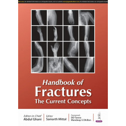 HANDBOOK OF FRACTURES THE CURRENT CONCEPTS book by Abdul Ghani, Samarth Mittal