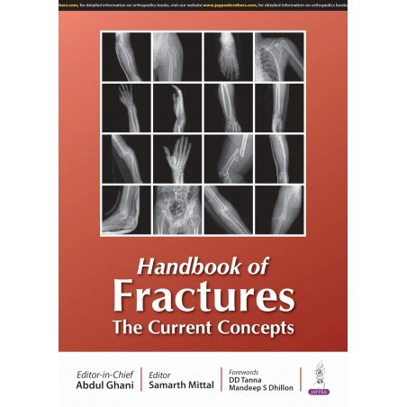 HANDBOOK OF FRACTURES THE CURRENT CONCEPTS book by Abdul Ghani, Samarth Mittal