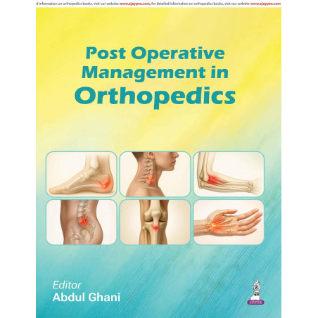 Post Operative Management in Orthopedics for Orthopedic Residents, Surgeons and Trauma Specialists | ERAS Protocols, Fluid-E…