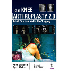 Total Knee Arthroplasty 2.0 book by Apurv Mehra, Heiko Graichen