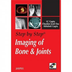 Step By Step Imaging Of Bone Joints book