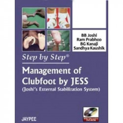 Step by Step Management of Clubfoot by JESS (Joshi's External Stabilization System) with Interactive DVD-ROM (POD) book by J…