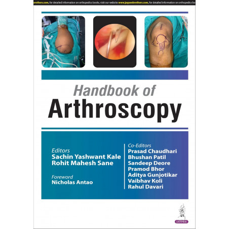 HANDBOOK OF ARTHOSCOPY book by Sachin Yashwant Kale, Rohit Mahesh Sane