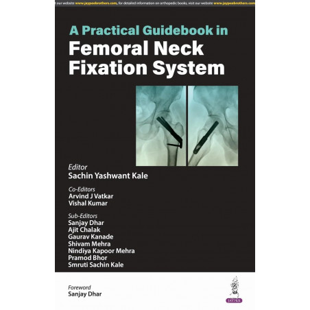 A PRACTICAL GUIDEBOOK IN FEMORAL NECK FIXATION SYSTEM book by Sachin Yashwant Kale