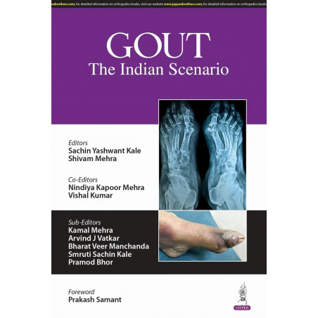 GOUT THE INDIAN SCENARIO book by Sachin Yashwant Kale, Shivam Mehra