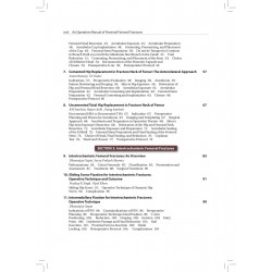 AN OPERATIVE MANUAL OF PROXIMAL FEMORAL FRACTURES WITH DVD-ROM book by Dhananjay Gupta - Additional Image 7