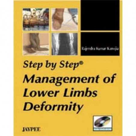 Step by Step Management of Lower Limbs Deformity with DVD-ROM book by Rajendra Kumar Kanojia
