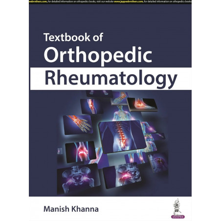 TEXTBOOK OF ORTHOPEDIC RHEUMATOLOGY book by Khanna Manish
