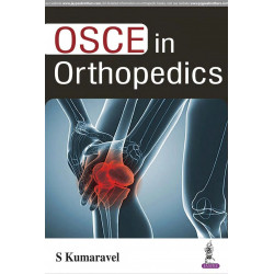 OSCE IN ORTHOPEDICS book by S Kumaravel