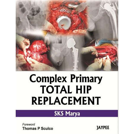 Complex Primary Total Hip Replacement book by Marya