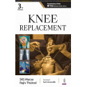 KNEE REPLACEMENT book by SKS Marya, Rajiv Thukral