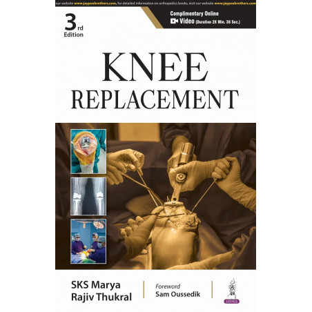 KNEE REPLACEMENT book by SKS Marya, Rajiv Thukral