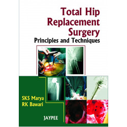 Total Hip Replacement Surgery: Principles and Techniques book by SKS Marya, RK Bawari