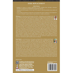 KNEE REPLACEMENT book by SKS Marya, Rajiv Thukral - Additional Image 3
