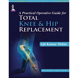 A PRACTICAL OPERATIVE GUIDE FOR TOTAL KNEE AND HIP REPLACEMENT book by Mehta Ajit Kumar