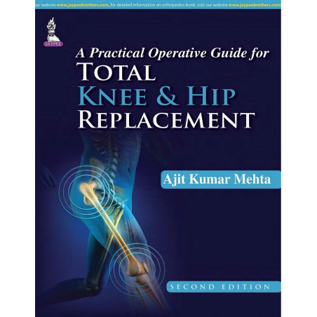 A PRACTICAL OPERATIVE GUIDE FOR TOTAL KNEE AND HIP REPLACEMENT book by Mehta Ajit Kumar