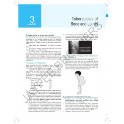 Orthopedics Quick Review (OPQR) book by MEHRA APURV - Additional Image 7