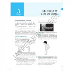 Orthopedics Quick Review (OPQR) book by MEHRA APURV - Additional Image 8
