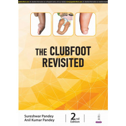 THE CLUBFOOT REVISITED book by Sureshwar Pandey, Anil Kumar Pandey