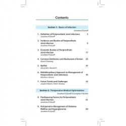 Periprosthetic Joint Infection: Updated Practical Management Guide book by Javad Parvizi - Additional Image 4