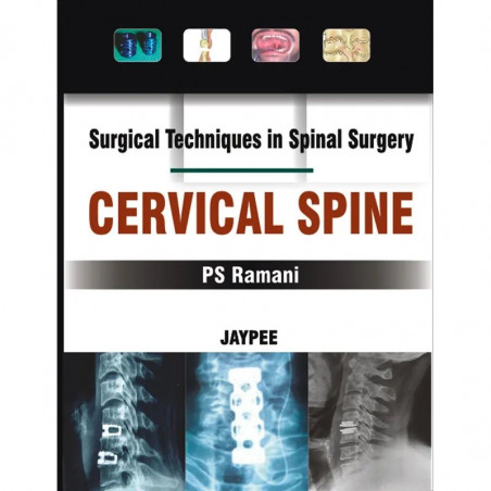 SURGICAL TECHNIQUES IN SPINAL SURGERY CERVICAL SPINE book by Ramani