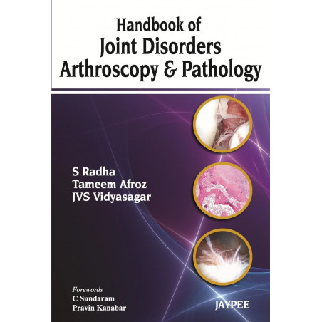HANDBOOK OF JOINT DISORDERS ARTHROSCOPY & PATHOLOGY book by Radha S