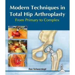 Modern Techniques in Total Hip Arthroplasty: From Primary to Complex book by Ran Schwarzkopf