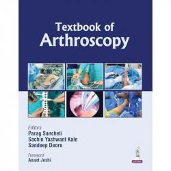 Textbook of Arthroscopy for Orthopedic Postgraduates, Fellows & Surgeons | Comprehensive Guide to Knee, Shoulder, Hip, Elbow… -