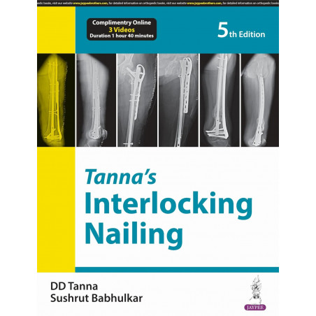 TANNA'S INTERLOCKING NAILING book by DD Tanna, Sushrut Babhulkar