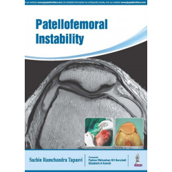 Patellofemoral Instability (POD) book by Tapasvi Sachin Ramchandra
