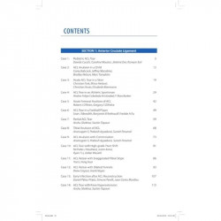 KNEE ARTHROSCOPY: A CASE REPOSITORY book by Sachin Tapasvi, Anshu Shekhar - Additional Image 4